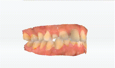 The intraoral data captured by Aoralscan 3